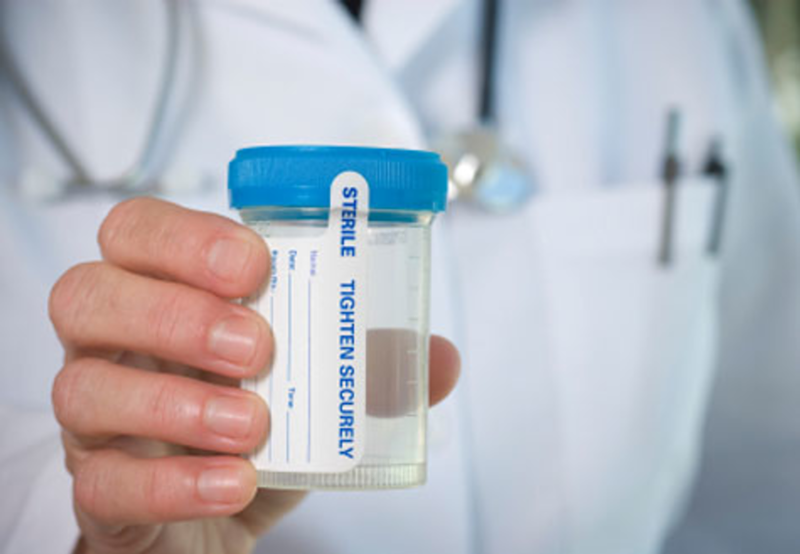 State Republicans Push Drug Test Requirement for Welfare