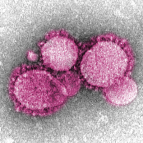 Coronavirus - Photo: Creative Commons