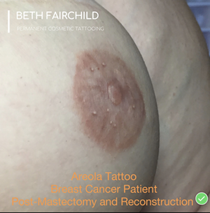 A example of one of Fairchild's 3D nipple tattoos - Photo: Provided by UC